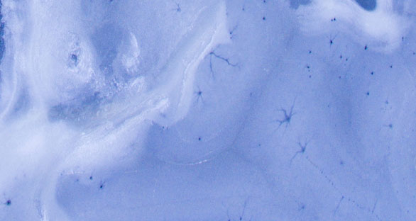 Teaching the GIVE skills (Part 1)